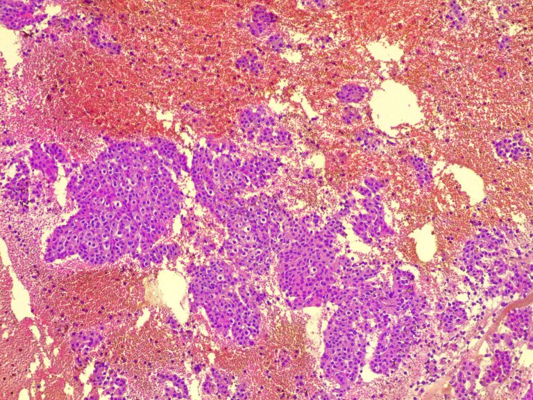 thyroid gland