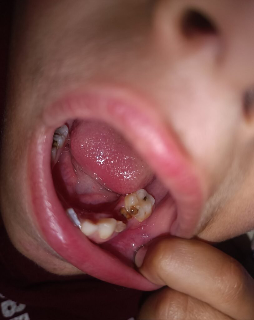 Ayurvedic oral care